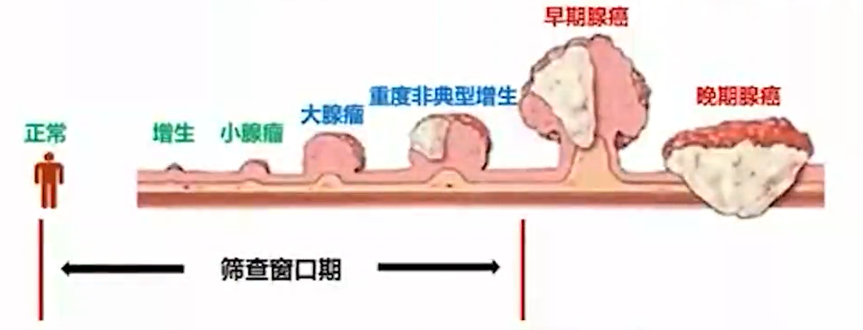 图444.png