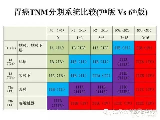 速查 | 胃癌CT的分期