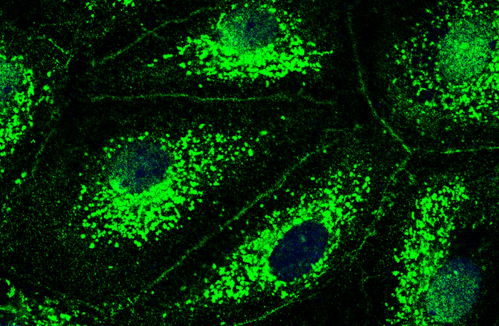 Science子刊发现囊性纤维化药物有助于治疗肺炎